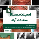 ایمپلنت دیجیتال سعادت آباد