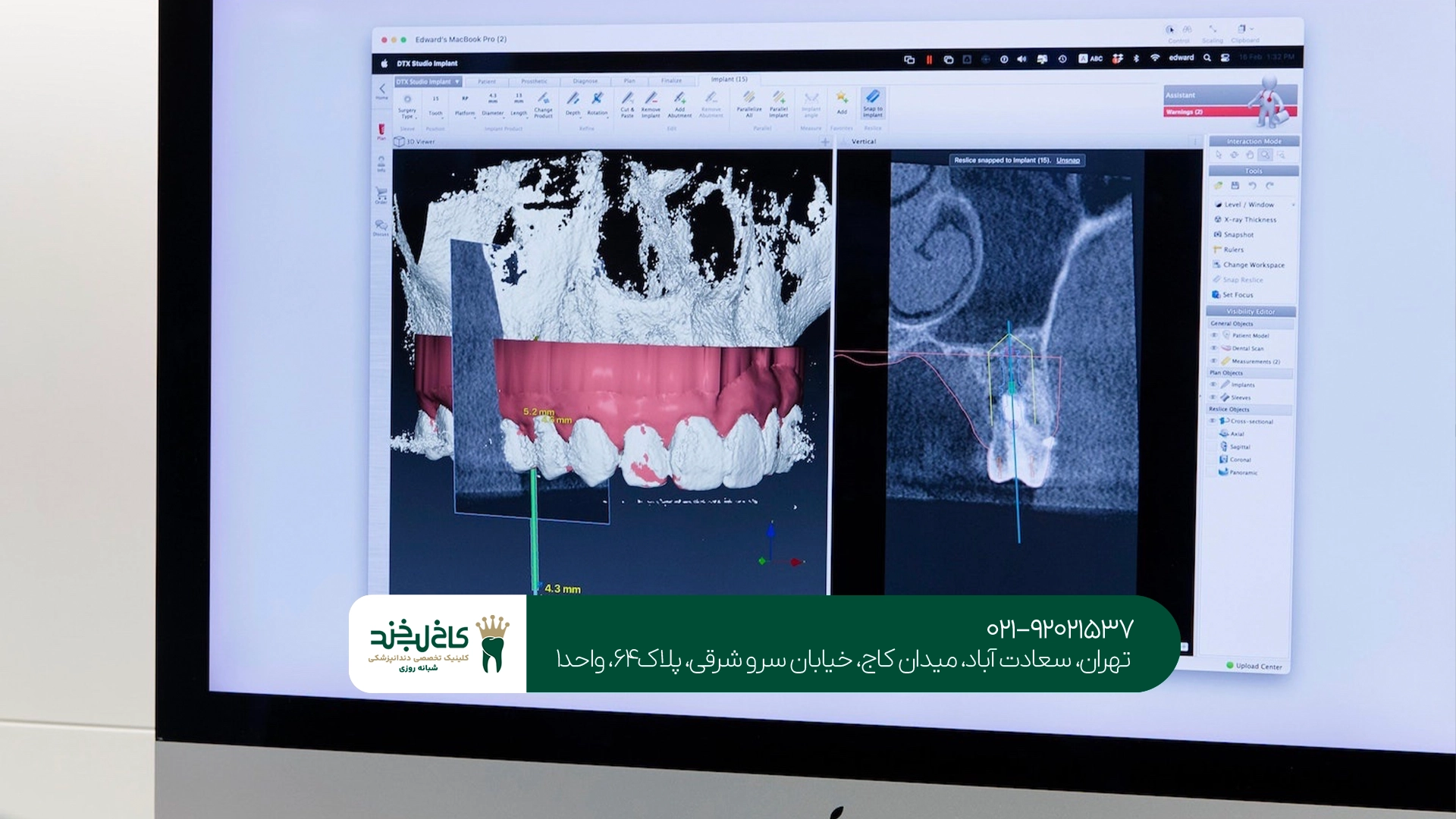 دندانپزشکی دیجیتال در تهران دندانپزشکی دیجیتال در تهران