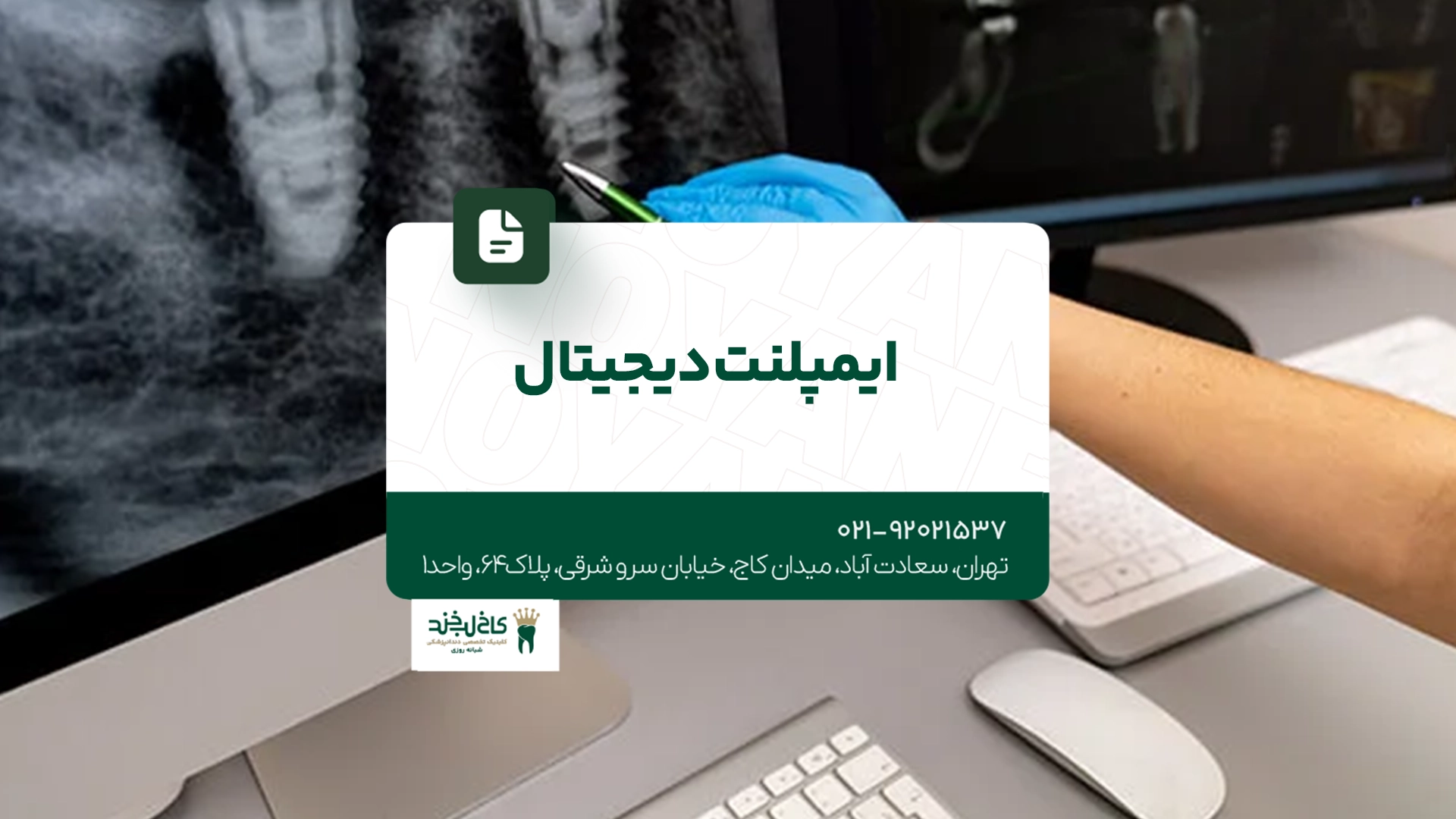 ایمپلنت دیجیتال ایمپلنت دیجیتال