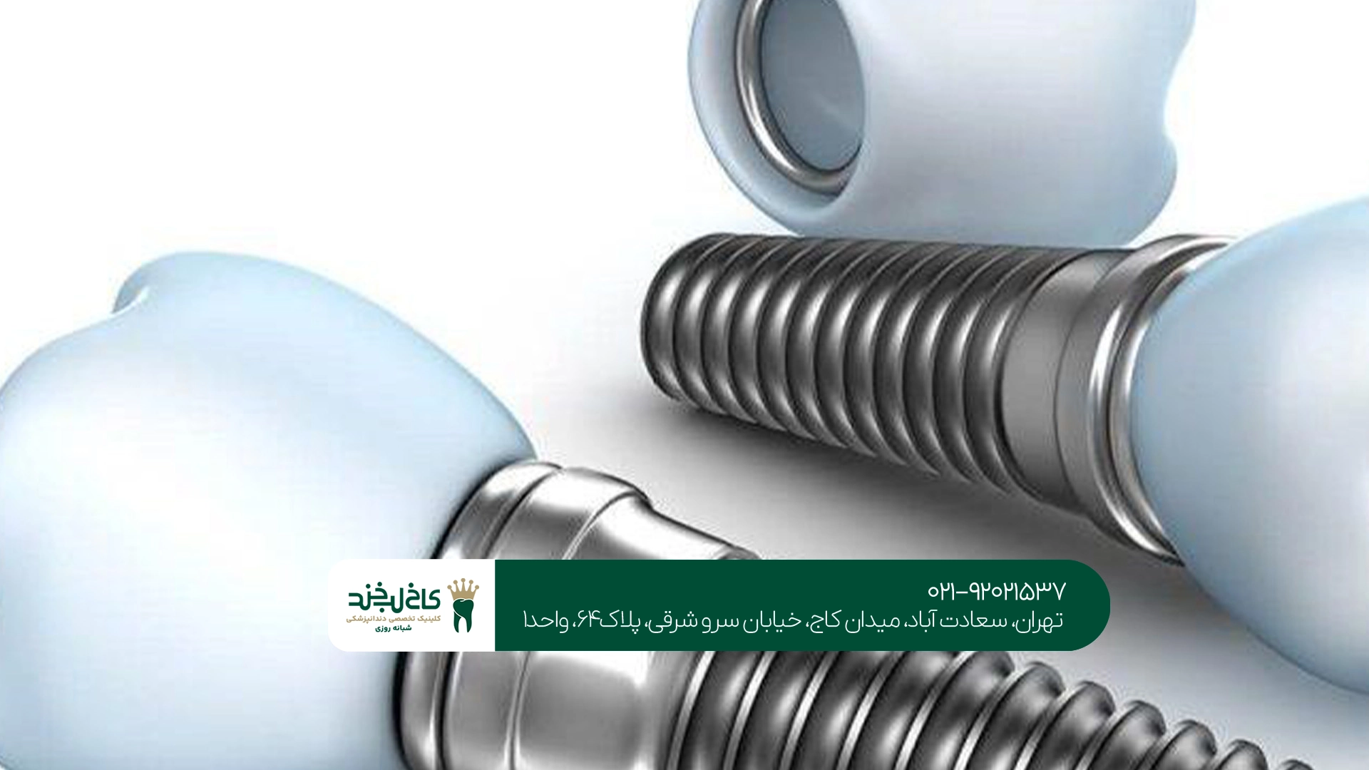 تخصصیترین کلینیک ایمپلنت سوئیسی تهران تخصصیترین کلینیک ایمپلنت سوئیسی تهران