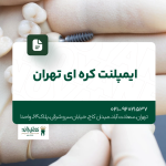 ایمپلنت کره ای تهران