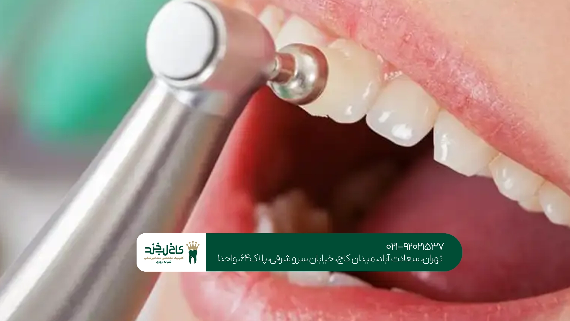 کلینیک بروساژ و پاکسازی دندان
