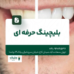بلیچینگ حرفه ای