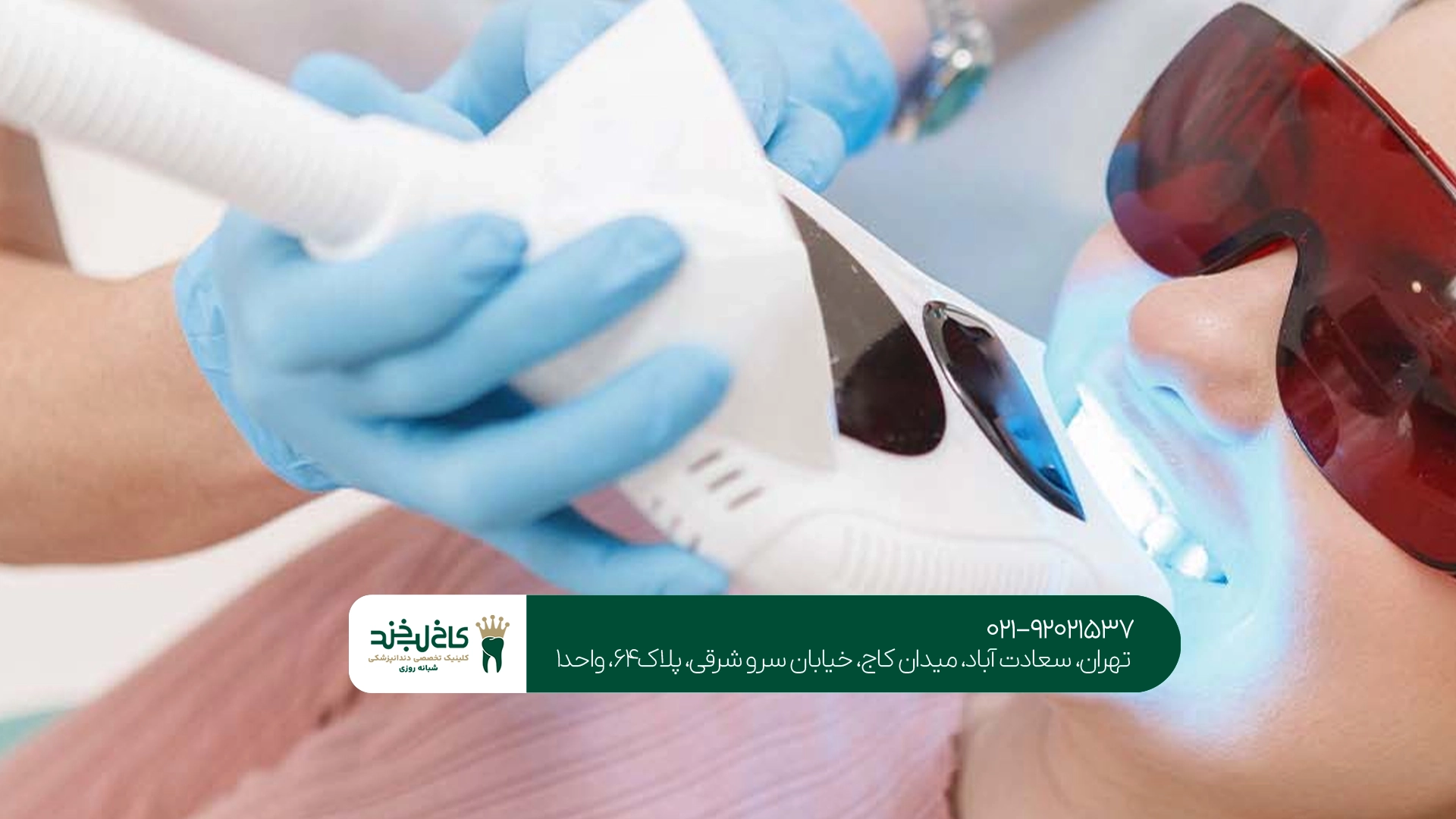 بلیچینگ دندان در تهران بلیچینگ دندان در تهران