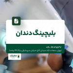 بلیچینگ دندان