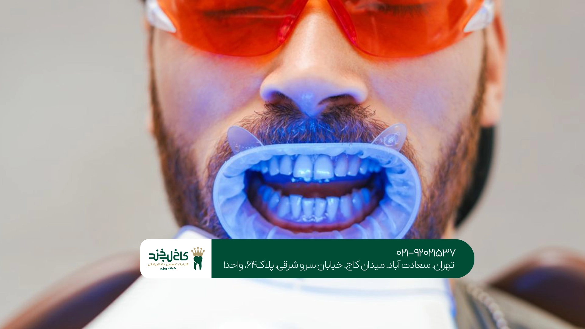 آیا بلیچینگ باعث حساسیت دندان میشود؟ آیا بلیچینگ باعث حساسیت دندان میشود؟