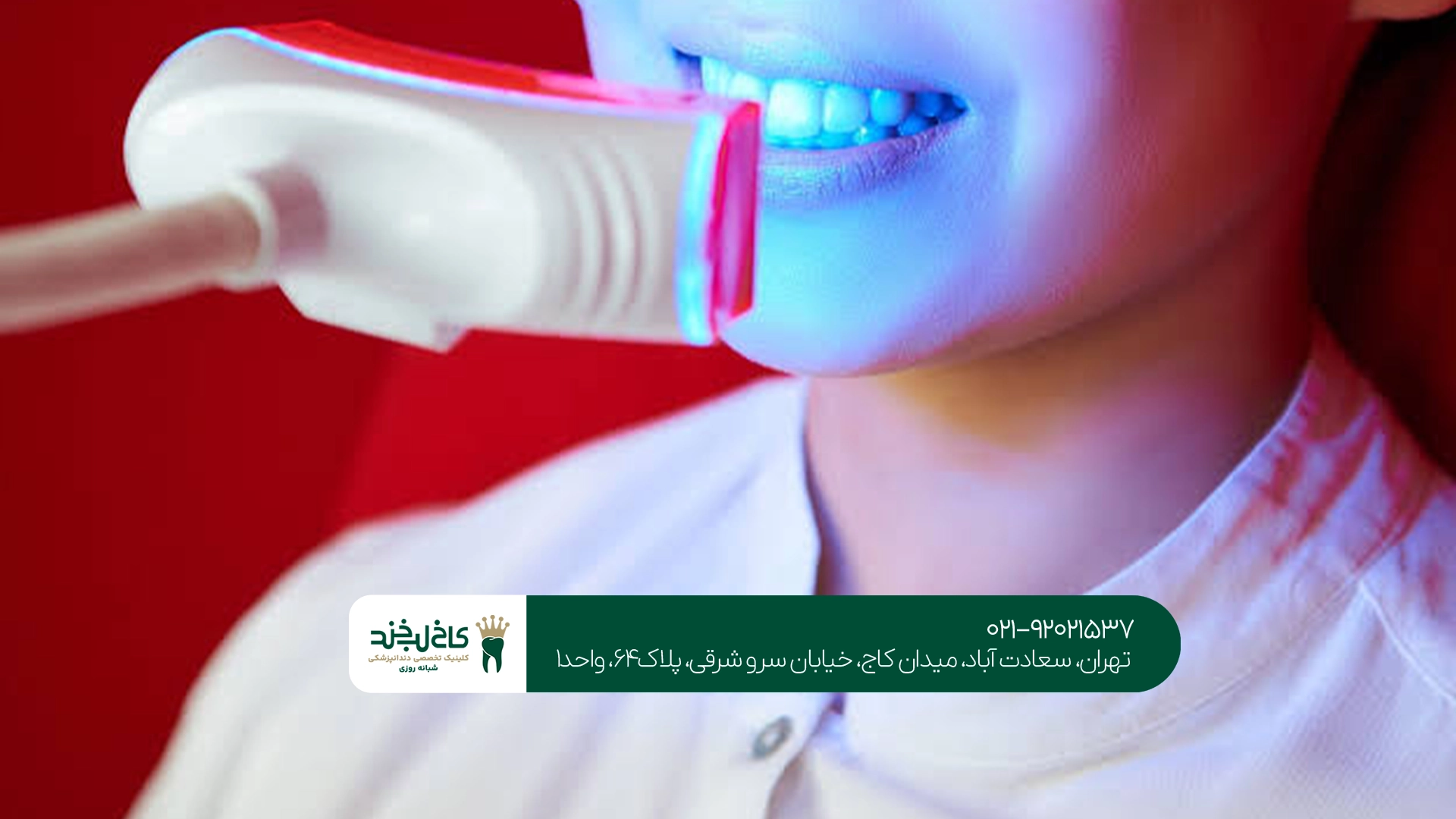 تفاوت جرمگیری و بلیچینگ دندان تفاوت جرمگیری و بلیچینگ دندان