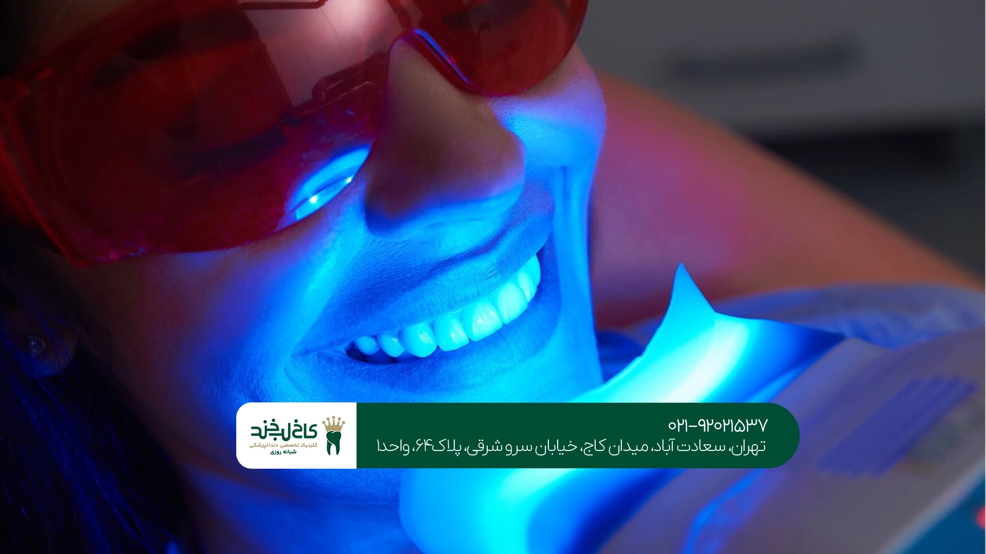 آیا بلیچینگ دندان برای همه مناسب است؟ آیا بلیچینگ دندان برای همه مناسب است؟