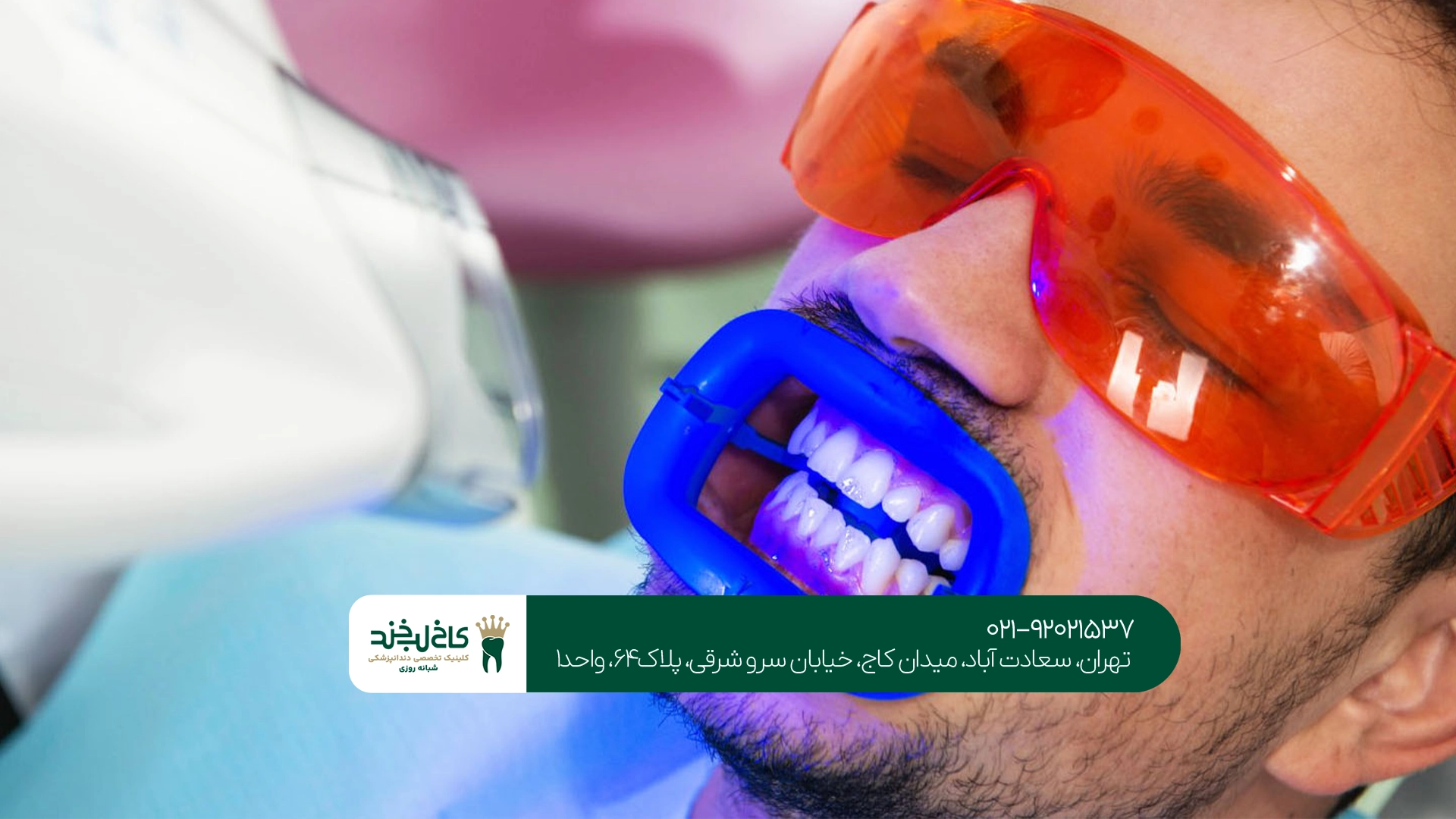 بلیچینگ دندان در کاخ لبخند بلیچینگ دندان در کاخ لبخند