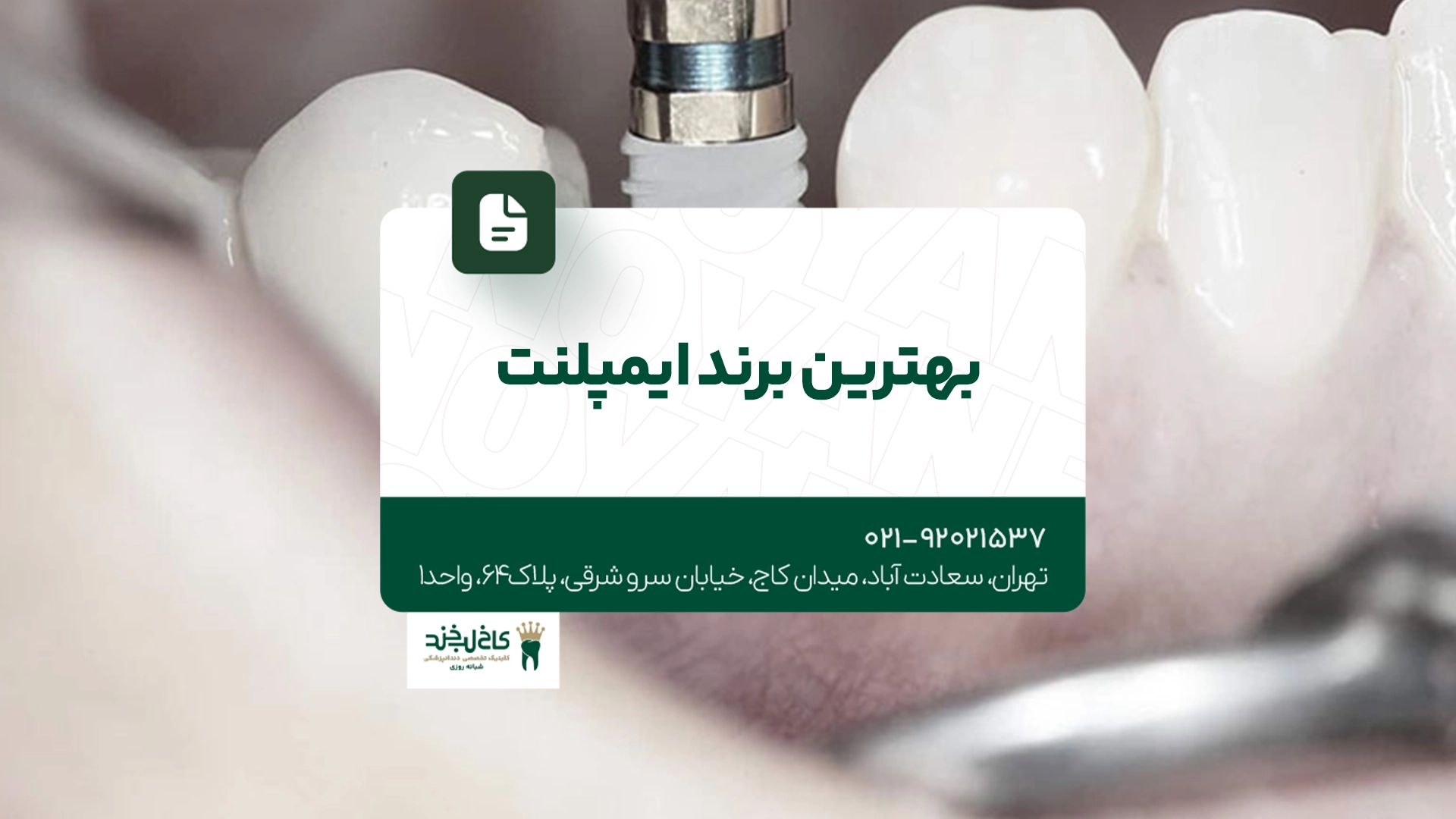 بهترین برند ایمپلنت بهترین برند ایمپلنت