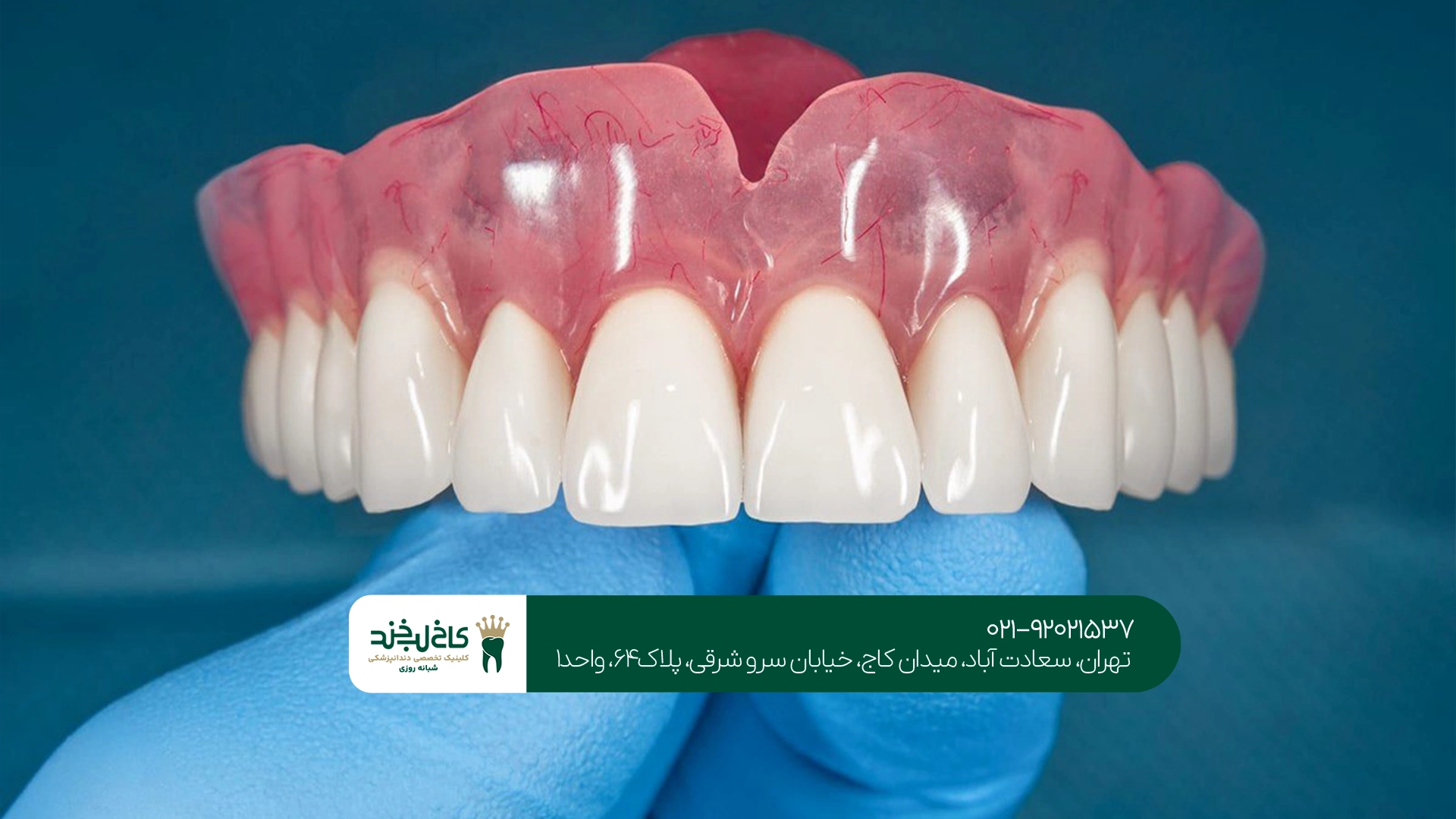 دندان مصنوعی با طراحی اختصاصی
