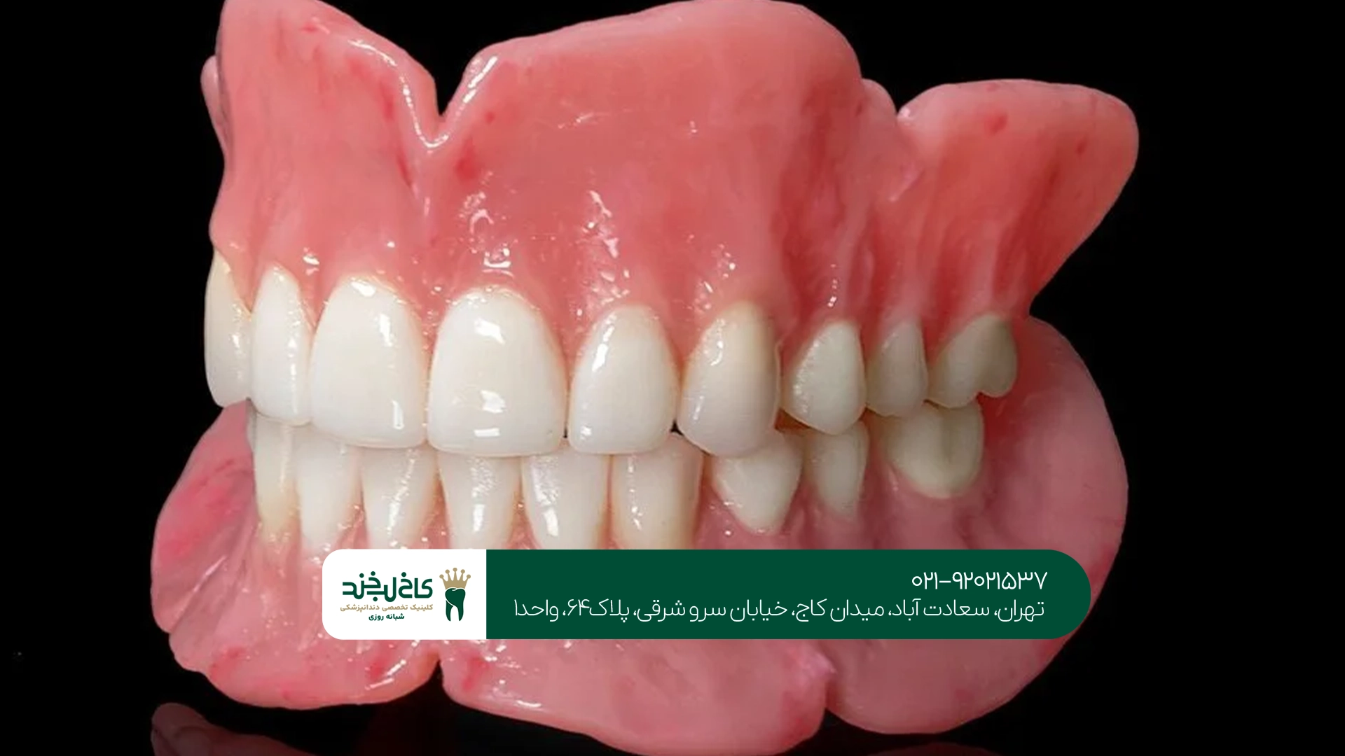 کدام نوع دندان مصنوعی بهتر است؟