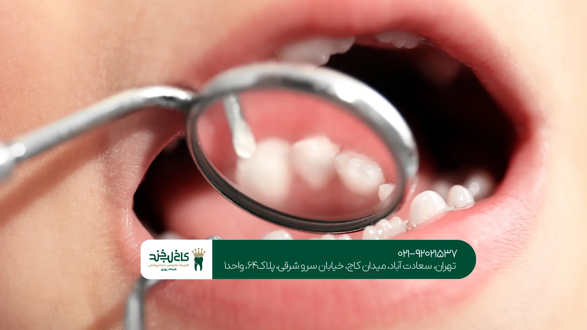 چگونه بهترین دندانپزشک تهران را انتخاب کنیم؟