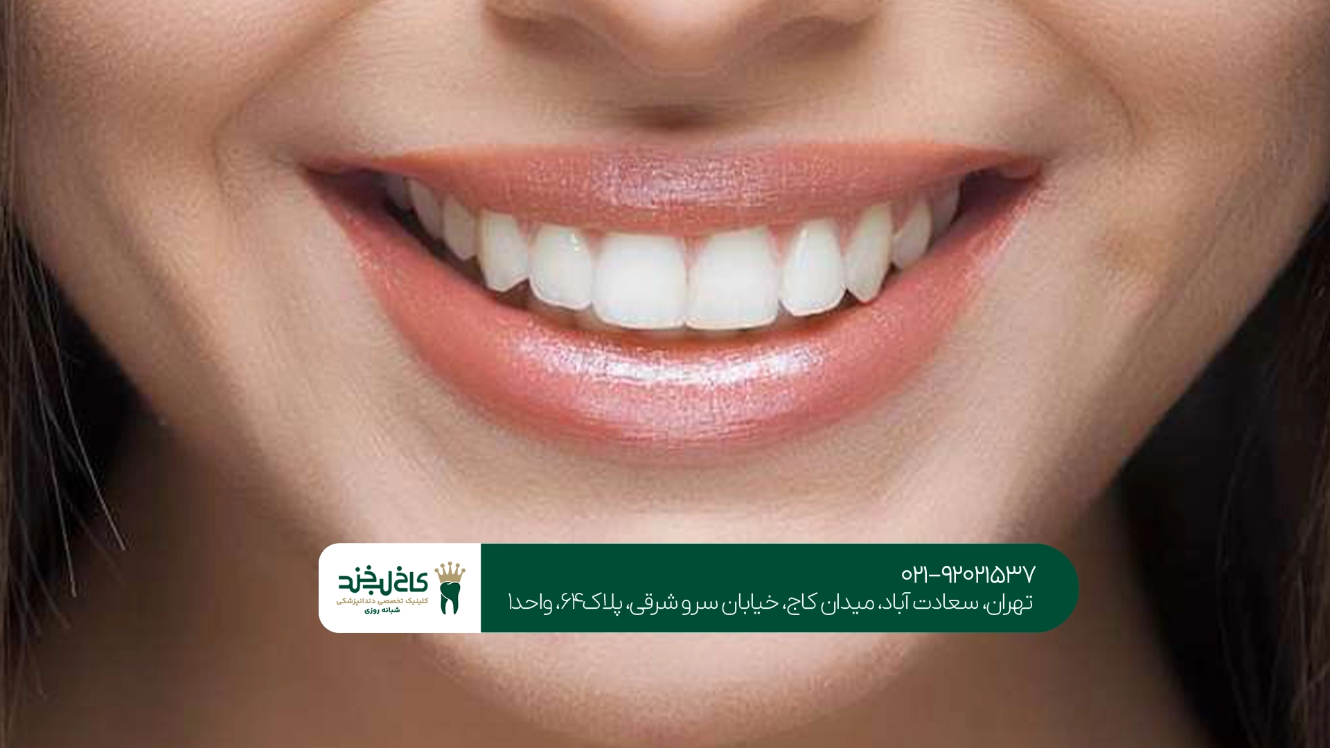 بهترین دندانپزشکی سعادت آباد