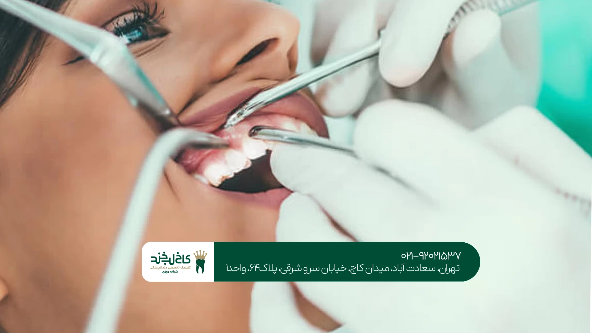 خدمات دندانپزشکی زیبایی در سعادت آباد چیست؟