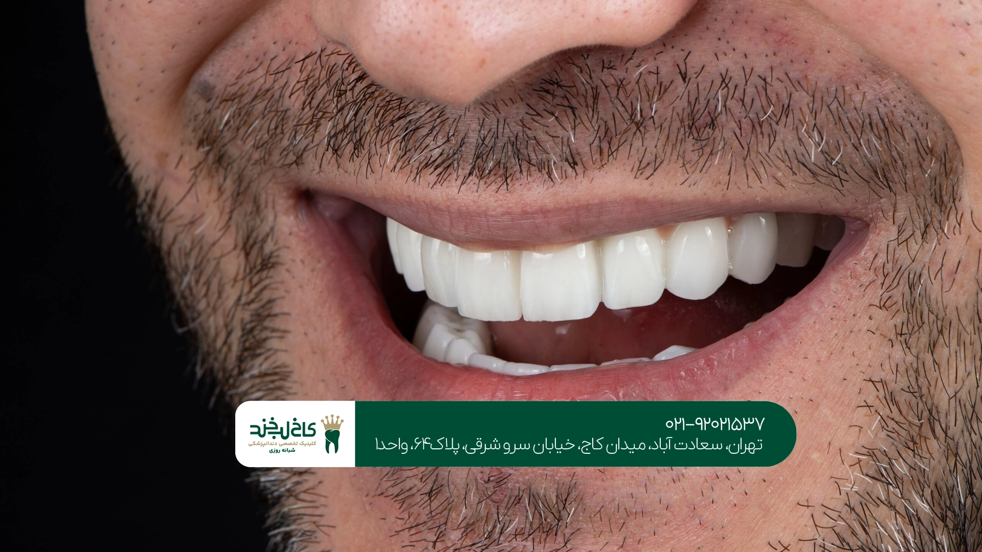 بهترین دندانپزشکی زیبایی بهترین دندانپزشکی زیبایی