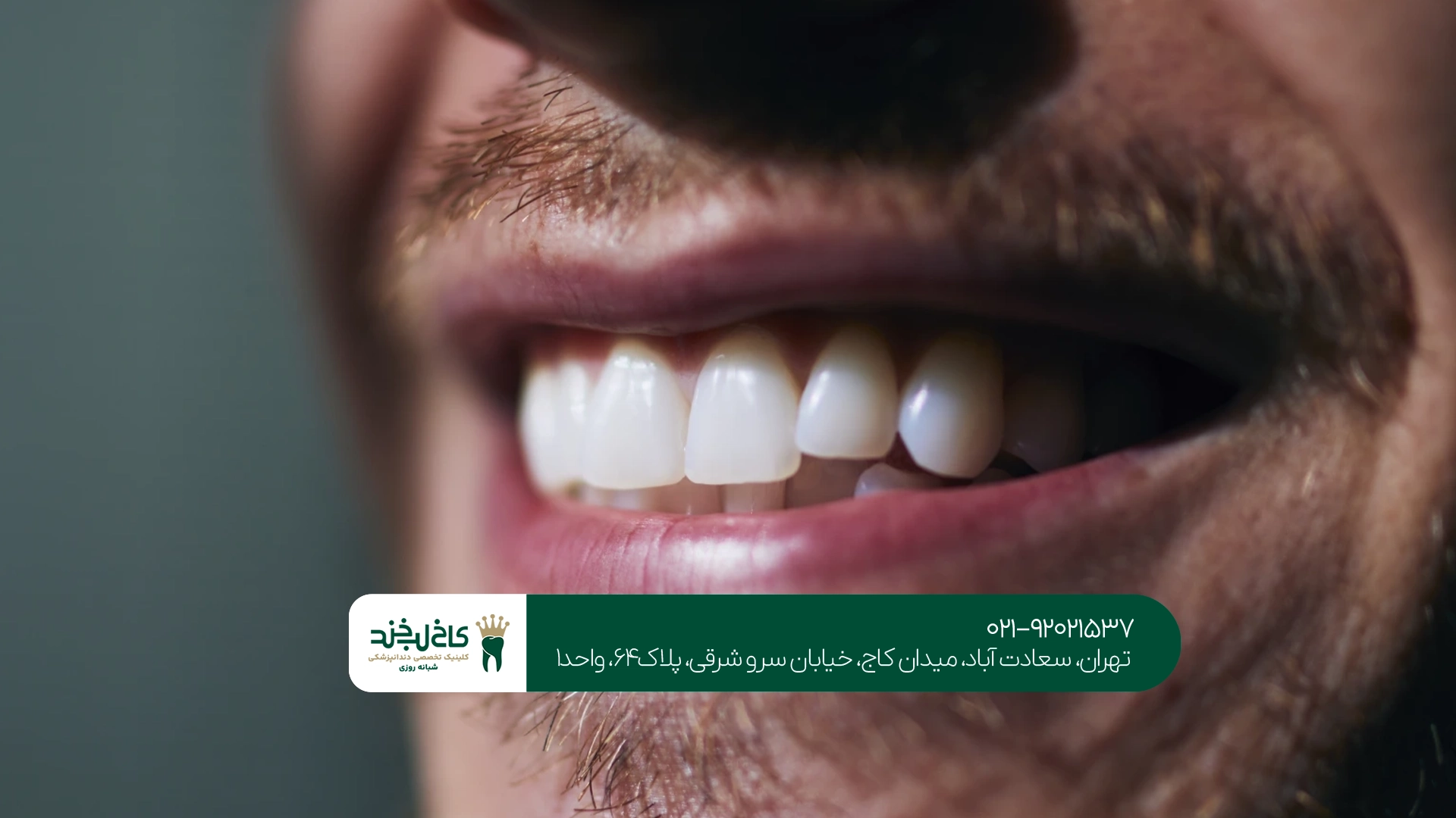 بهترین دندانپزشک زیبایی برای طراحی لبخند بهترین دندانپزشک زیبایی برای طراحی لبخند