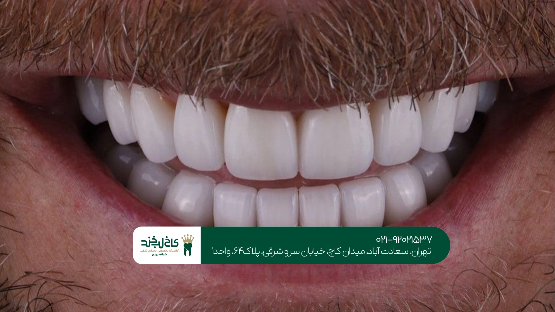 بهترین دندانپزشک زیبایی تهران بهترین دندانپزشک زیبایی تهران
