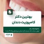 بهترین دکتر کامپوزیت دندان