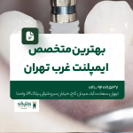 بهترین متخصص ایمپلنت غرب تهران