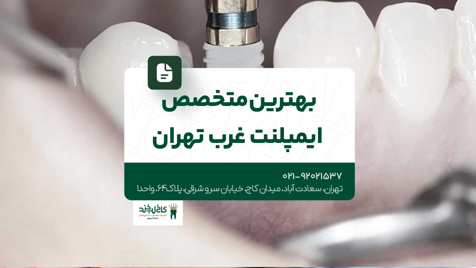 بهترین متخصص ایمپلنت غرب تهران
