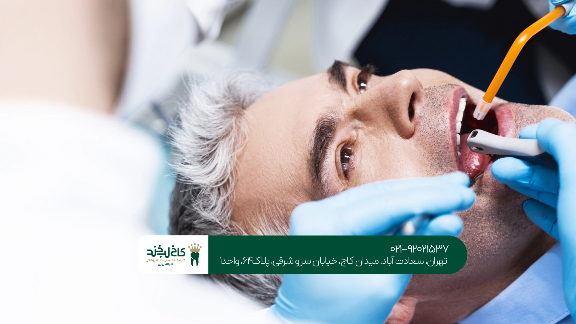 مراقبتهای بعد از درمان ریشه مراقبتهای بعد از درمان ریشه