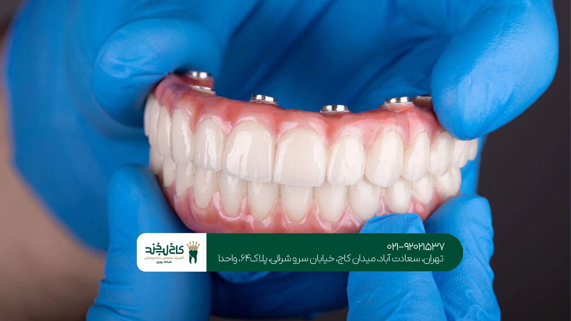 پروتز دندان تهران پروتز دندان تهران