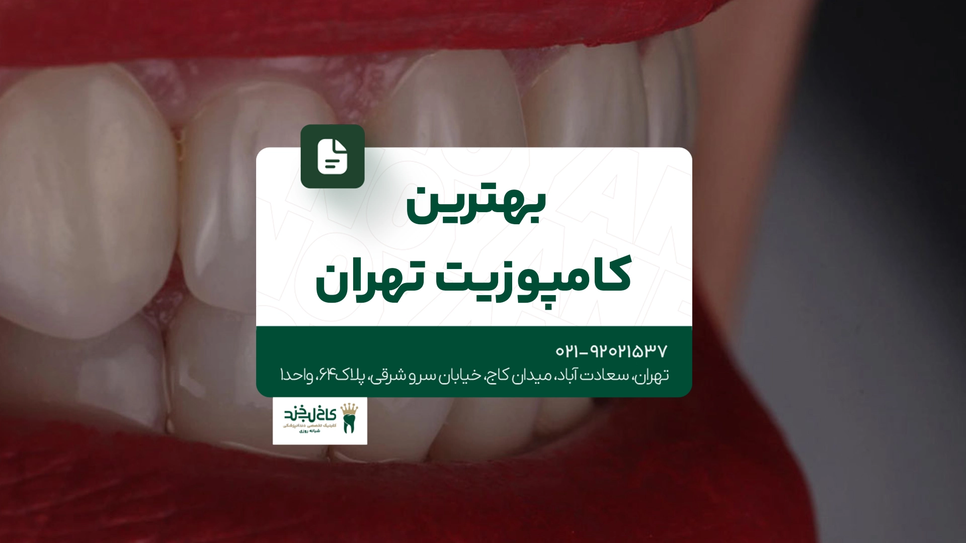 بهترین کامپوزیت تهران