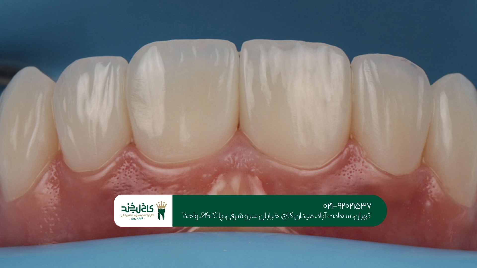 بهترین کلینیک کامپوزیت تهران
