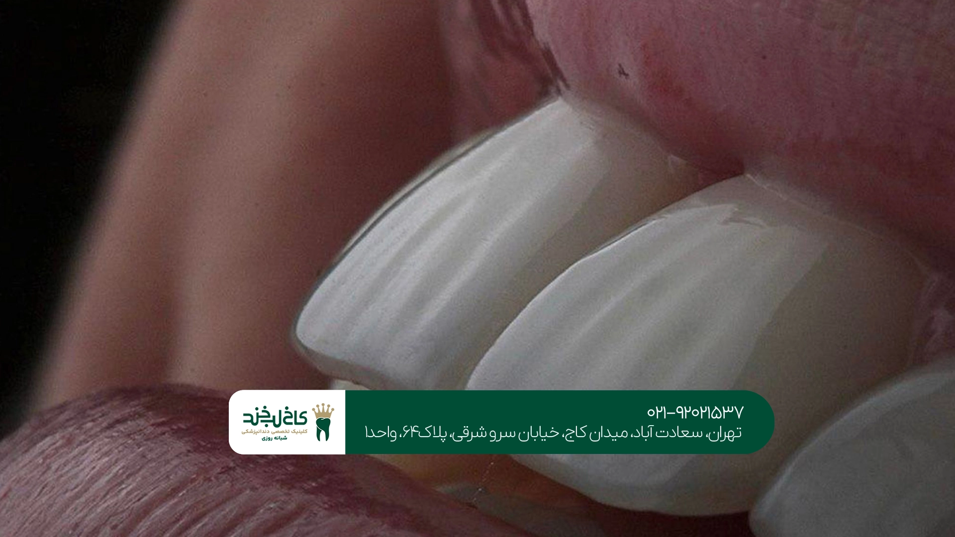 کلینیک تخصصی کامپوزیت تهران