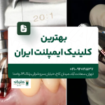 بهترین کلینیک ایمپلنت ایران