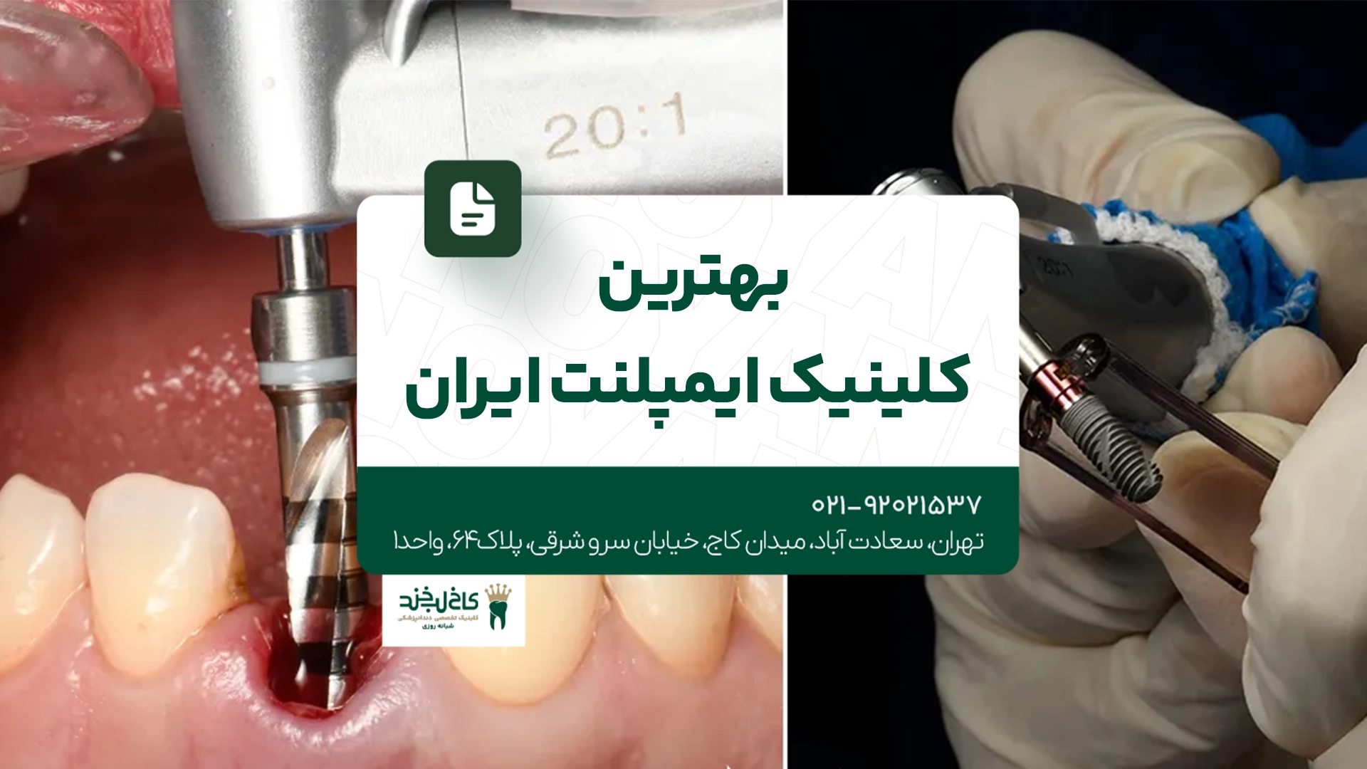 بهترین کلینیک ایمپلنت ایران بهترین کلینیک ایمپلنت ایران
