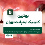 بهترین ایمپلنت دندان تهران