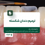ترمیم دندان شکسته