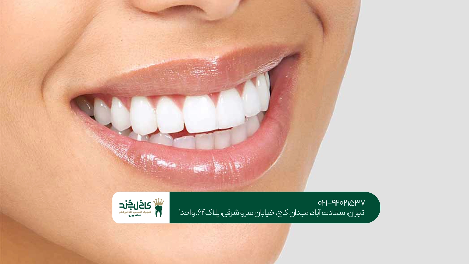بهترین مرکز ترمیم زیبایی دندان