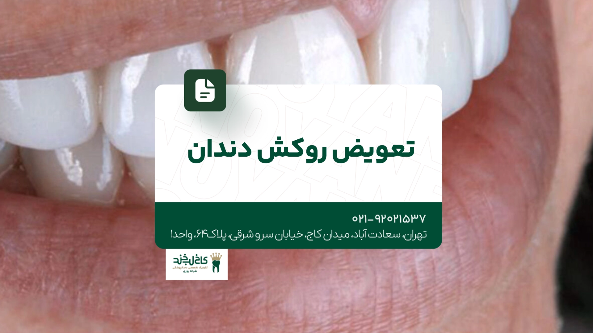 تعویض روکش دندان