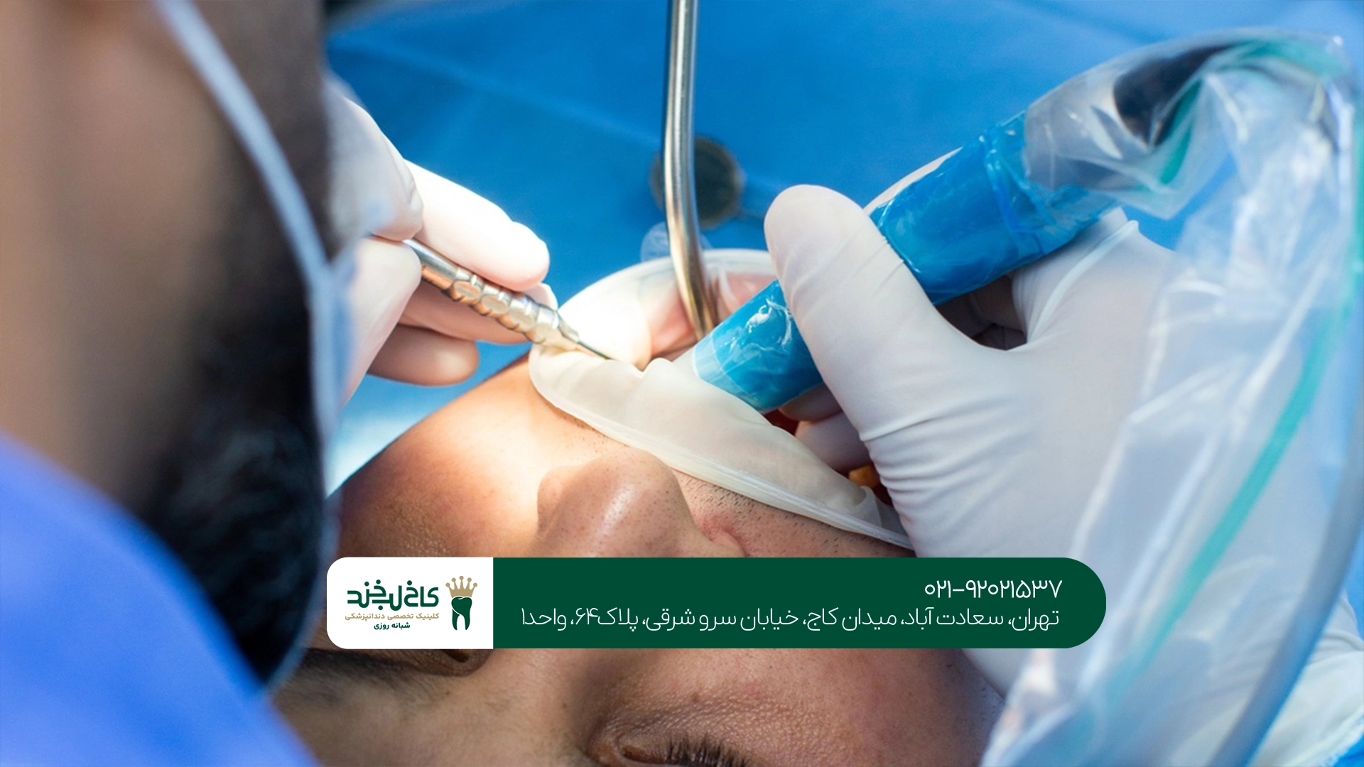 جراحی دندان عقل جراحی دندان عقل