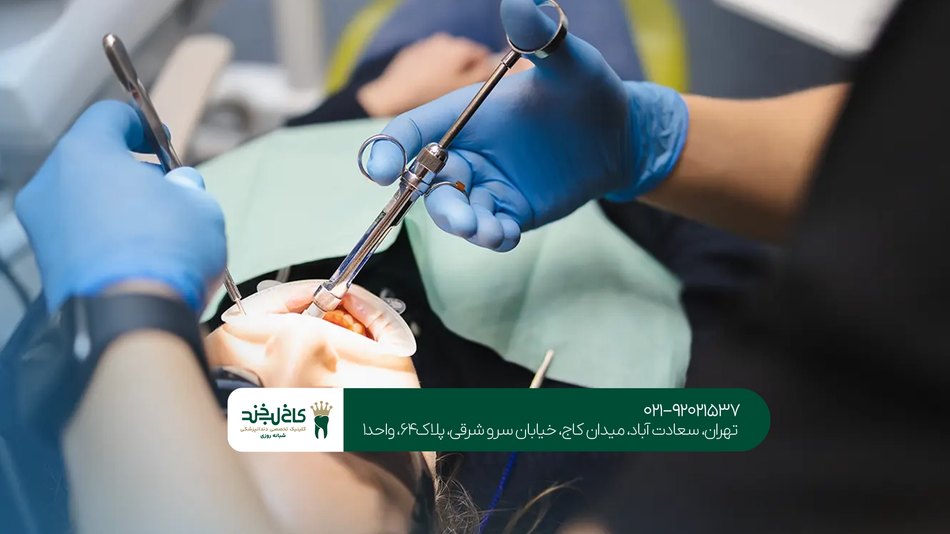 بهترین جراحی دندان عقل تهران بهترین جراحی دندان عقل تهران