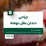 جراحی دندان عقل نهفته