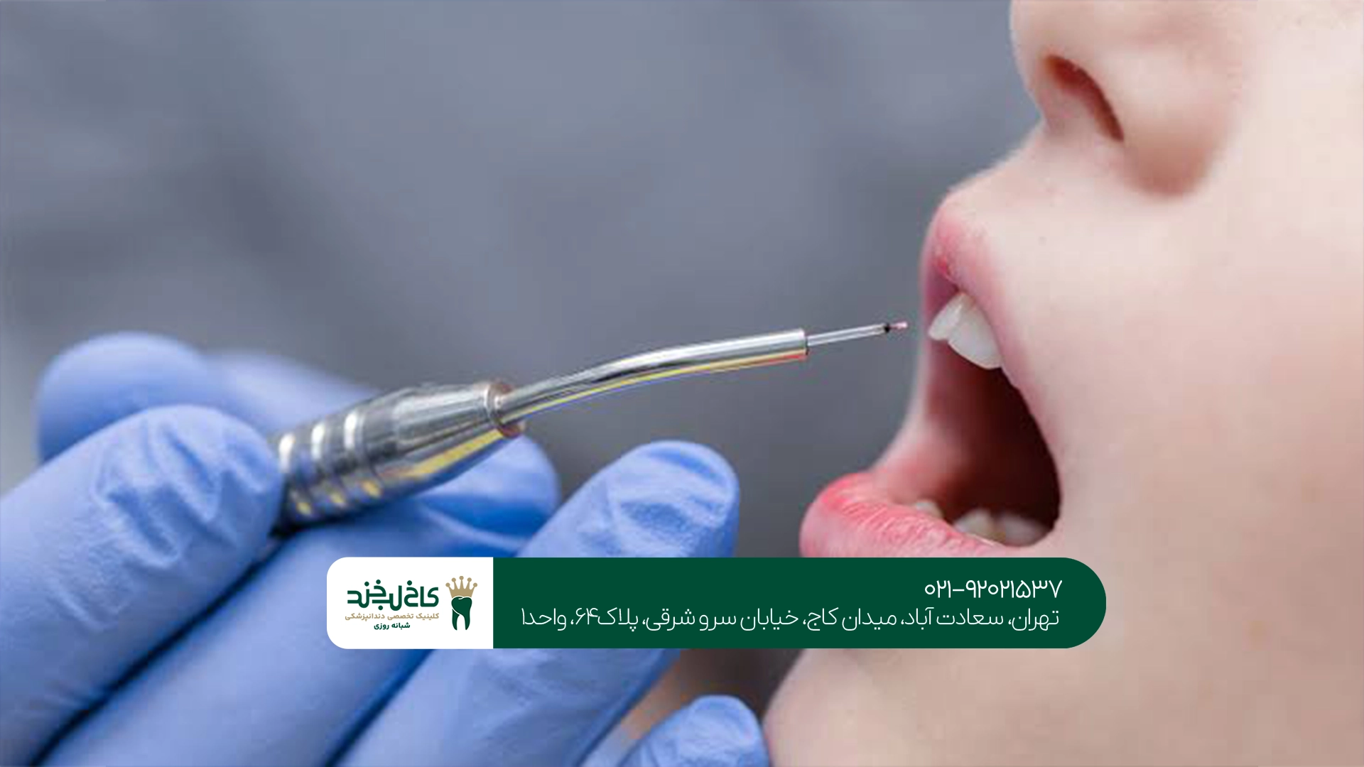 آیا لیزر برای جراحی و کشیدن دندان استفاده میشود؟ آیا لیزر برای جراحی و کشیدن دندان استفاده میشود؟