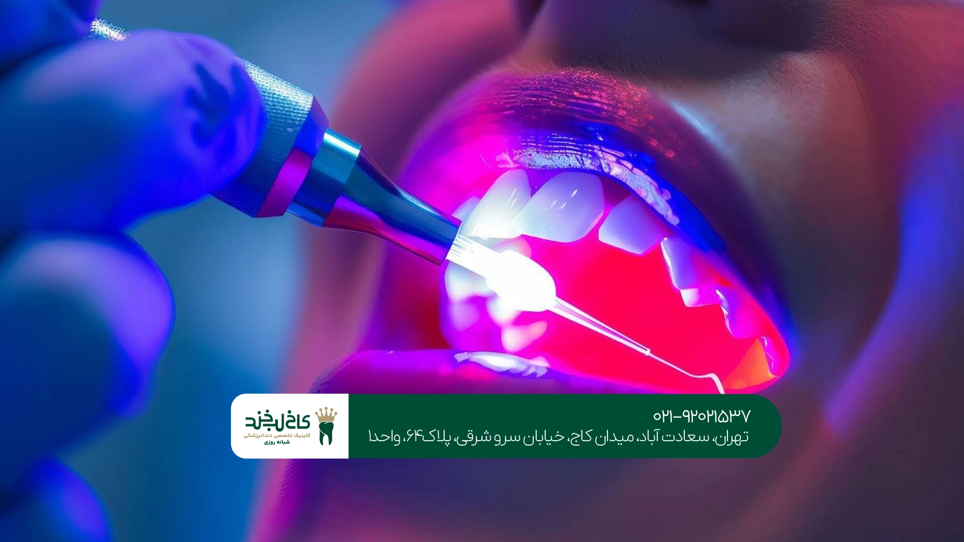 مراحل جراحی دندان لیزری در کاخ لبخند مراحل جراحی دندان لیزری در کاخ لبخند