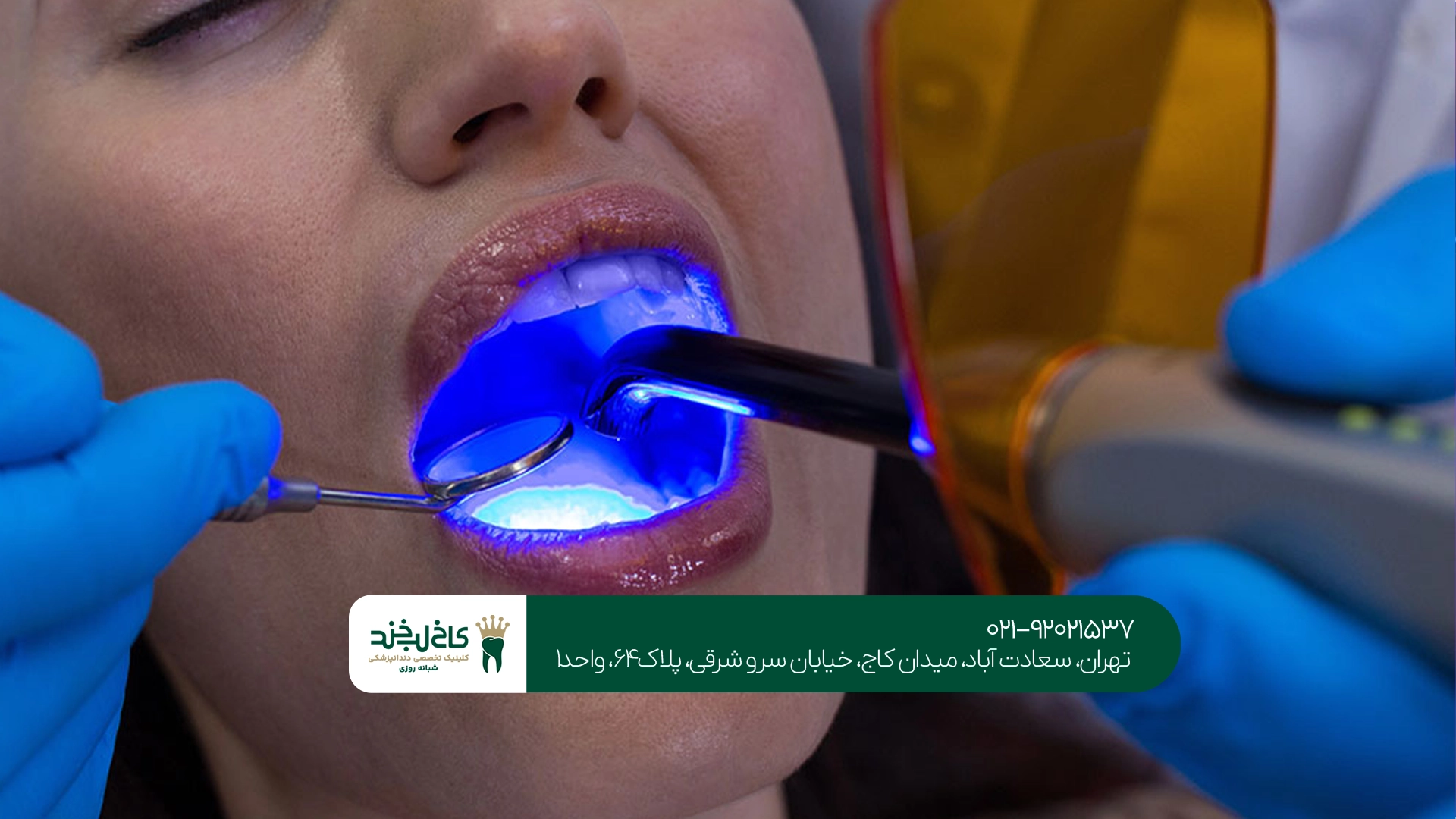 جراحی دندان لیزری بهتر است یا روش معمول؟ جراحی دندان لیزری بهتر است یا روش معمول؟