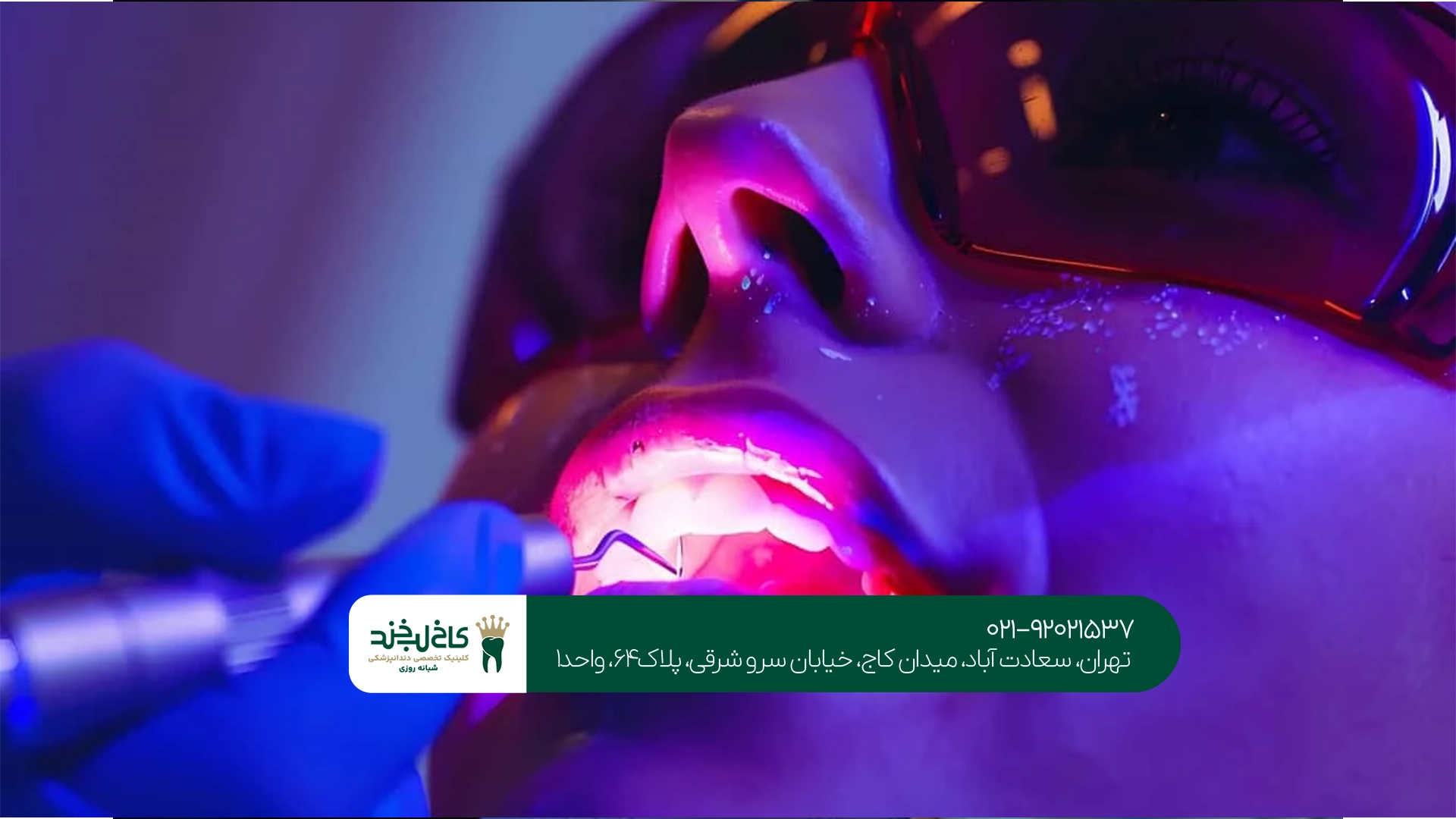 هزینه جراحی دندان با لیزر چقدر است؟ هزینه جراحی دندان با لیزر چقدر است؟