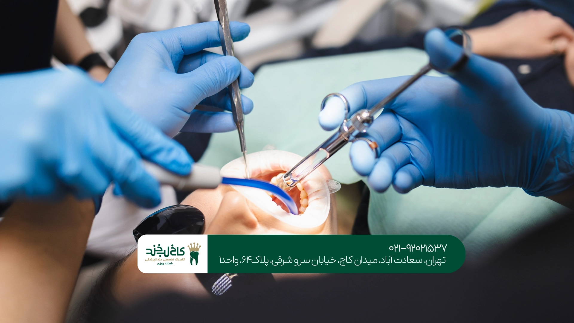 جراحی دهان سعادت آباد