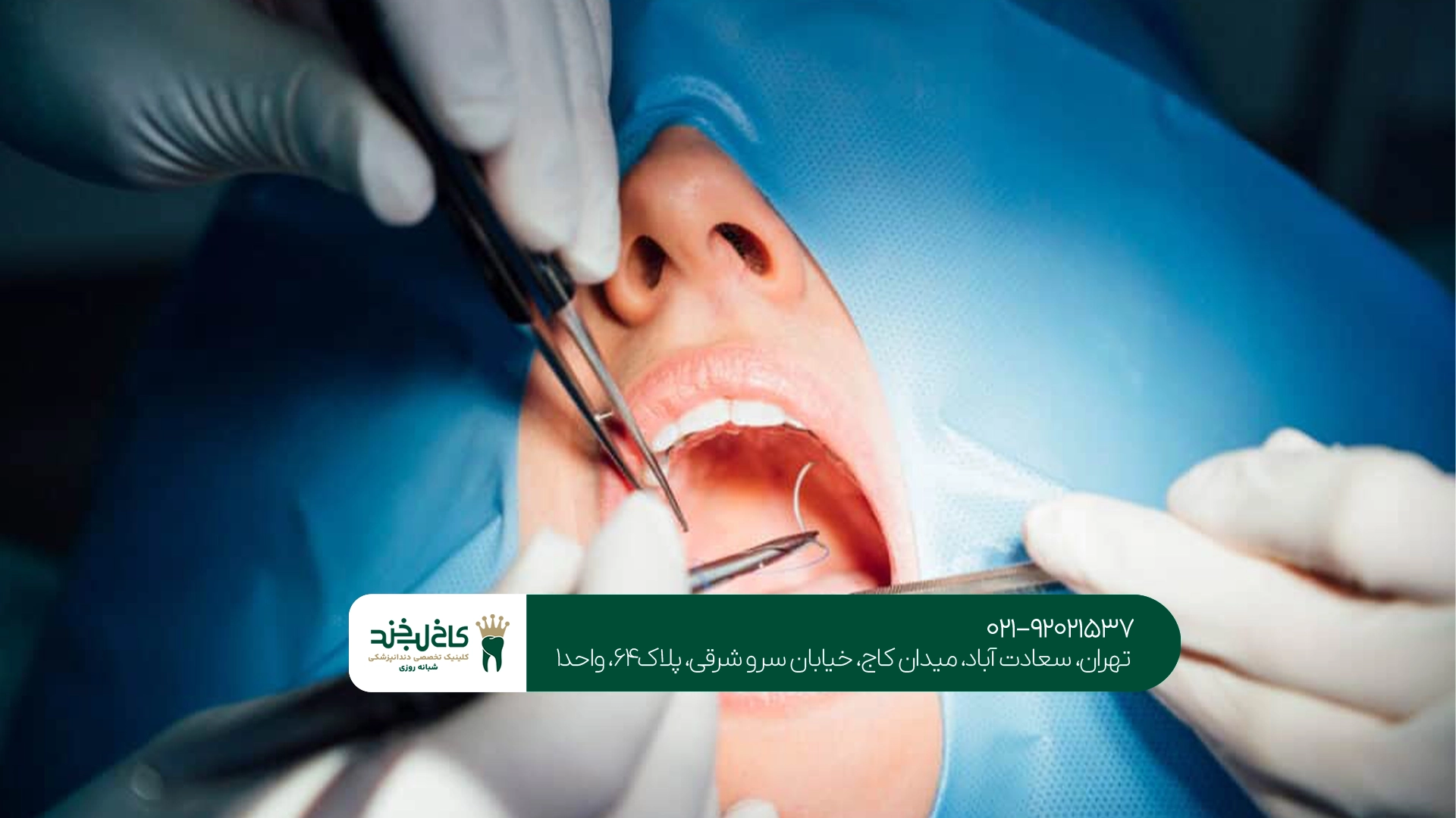 جراحی دهان چقدر درد دارد؟