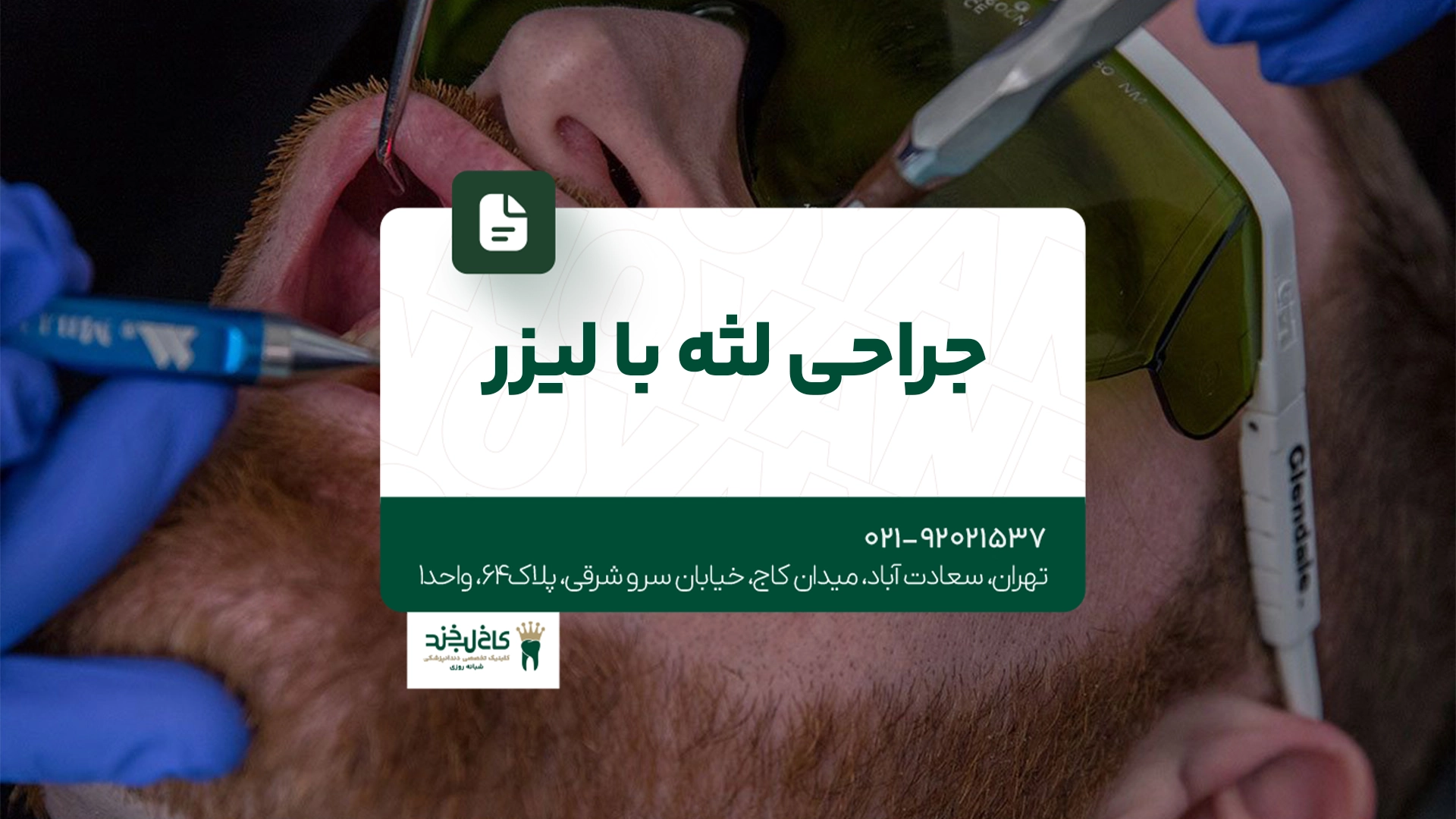 جراحی لثه با لیزر جراحی لثه با لیزر