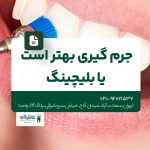 جرم گیری بهتر است یا بلچینگ