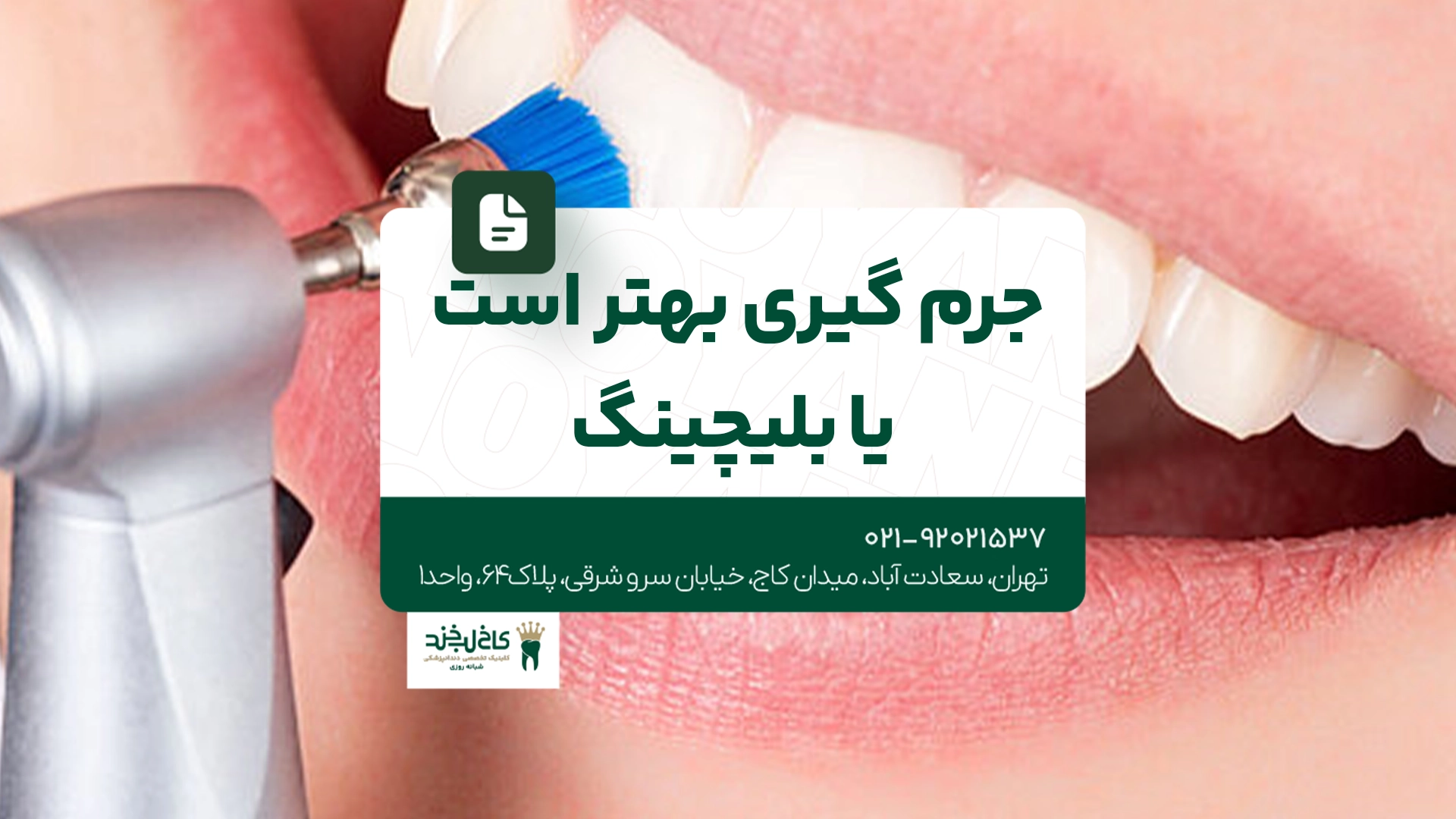 جرم گیری بهتر است یا بلچینگ