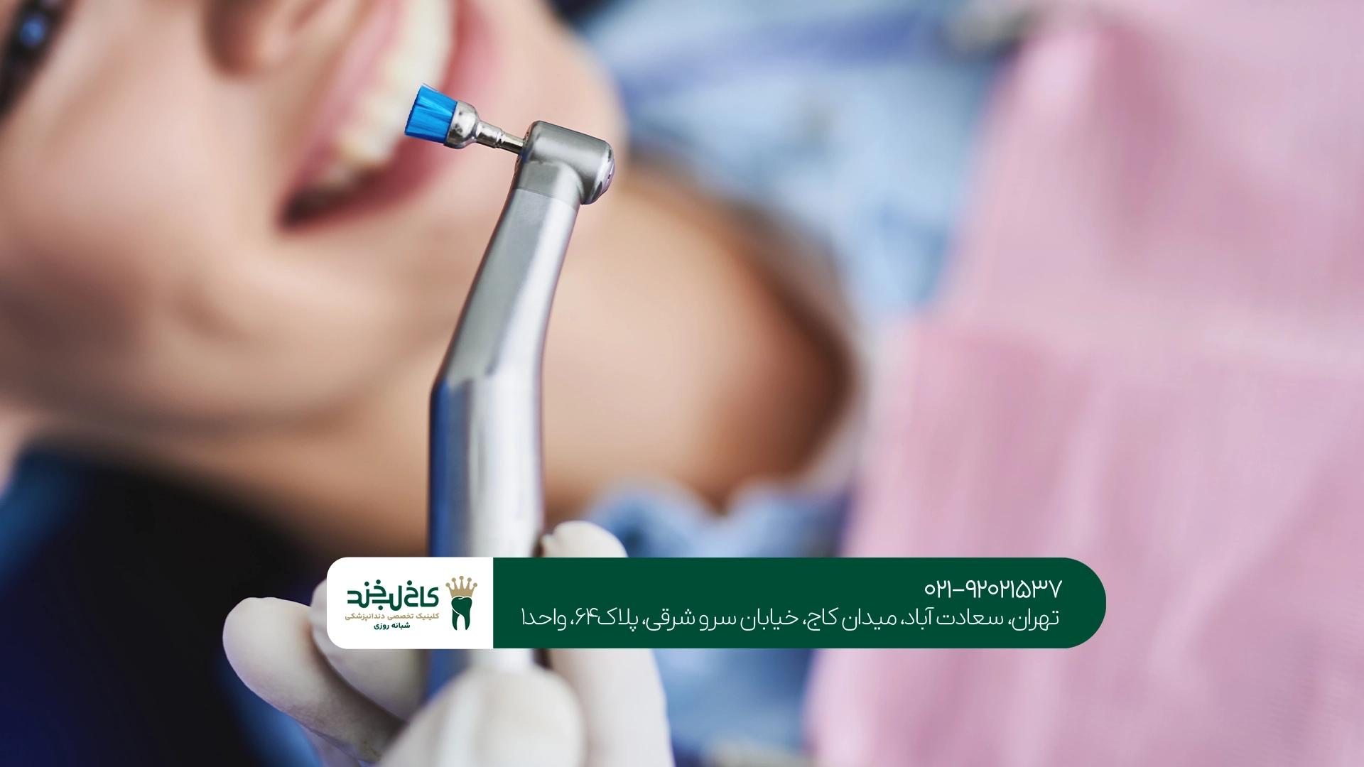 چرا باید جرمگیری دندان انجام بدهیم؟ چرا باید جرمگیری دندان انجام بدهیم؟