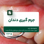 جرم گیری دندان